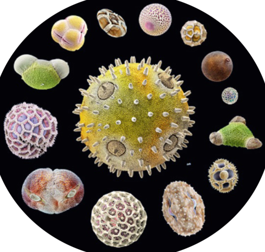 Composite image of several pollen grains photographed using a scanning electron microscope